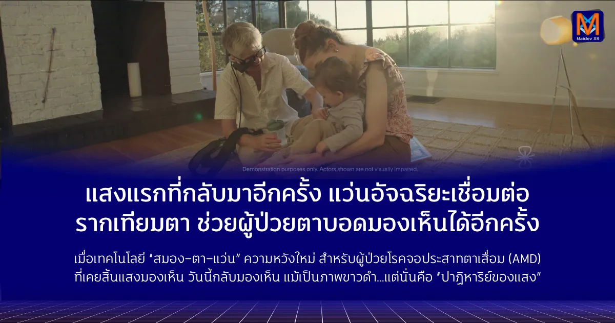แสงแรกที่กลับมาอีกครั้ง: แว่นอัจฉริยะเชื่อมต่อรากเทียมตา ช่วยผู้ป่วยตาบอดมองเห็นได้อีกครั้ง เมื่อเทคโนโลยี “สมอง–ตา–แว่น” รวมพลังกัน ความหวังใหม่จึงเกิดขึ้นสำหรับผู้ป่วยโรคจอประสาทตาเสื่อม (AMD) ที่เคยสิ้นแสงมองเห็น วันนี้พวกเขากลับมามองเห็นโลกอีกครั้ง แม้จะเป็นเพียงภาพขาวดำ…แต่นั่นคือ ปาฏิหาริย์ของแสง
